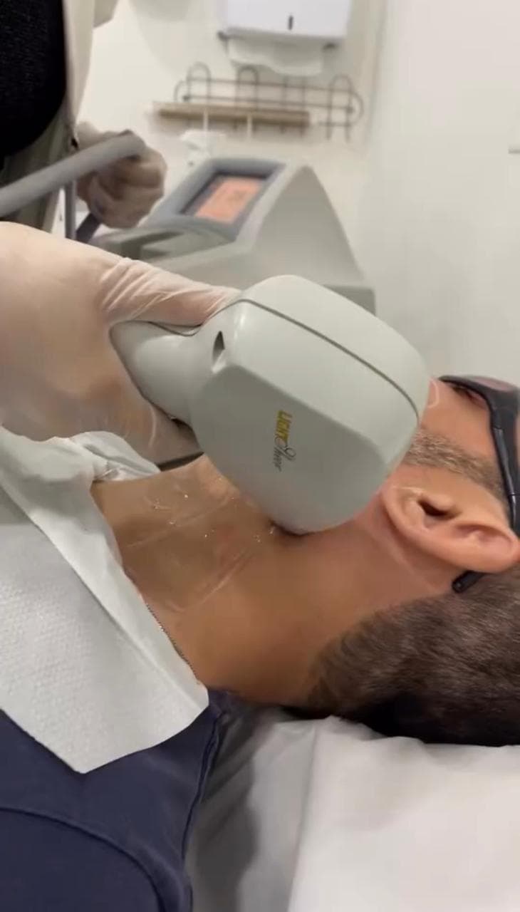 Depilação a laser masculina na Clínica Lev