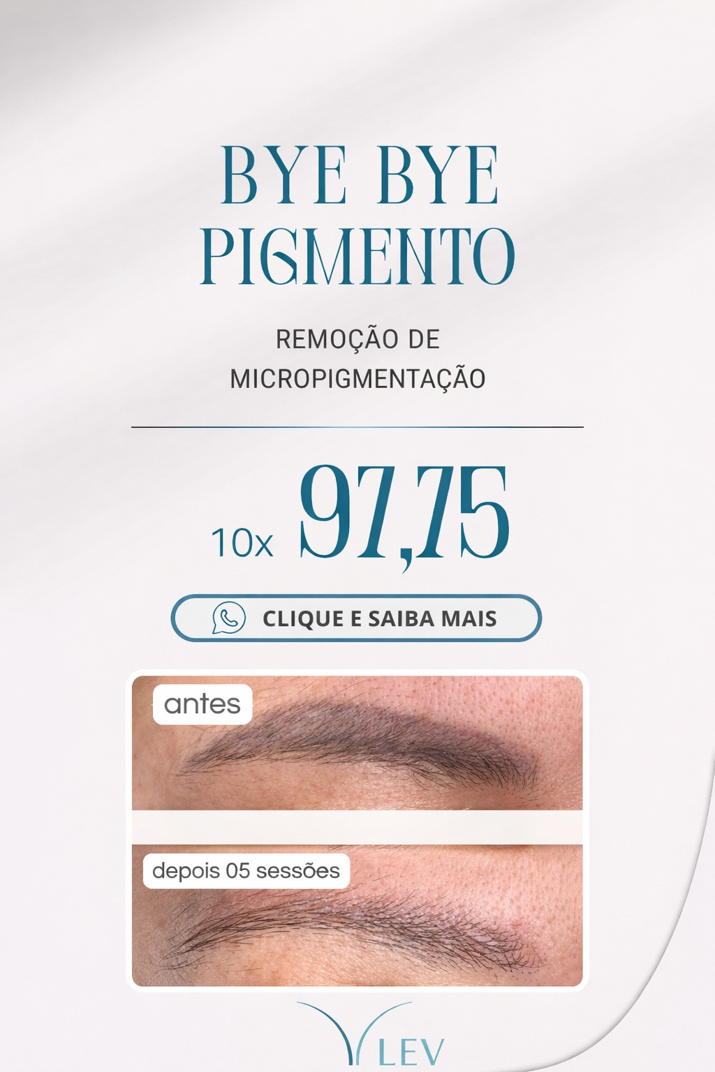 Clínica Lev - Bye Bye Pigmento