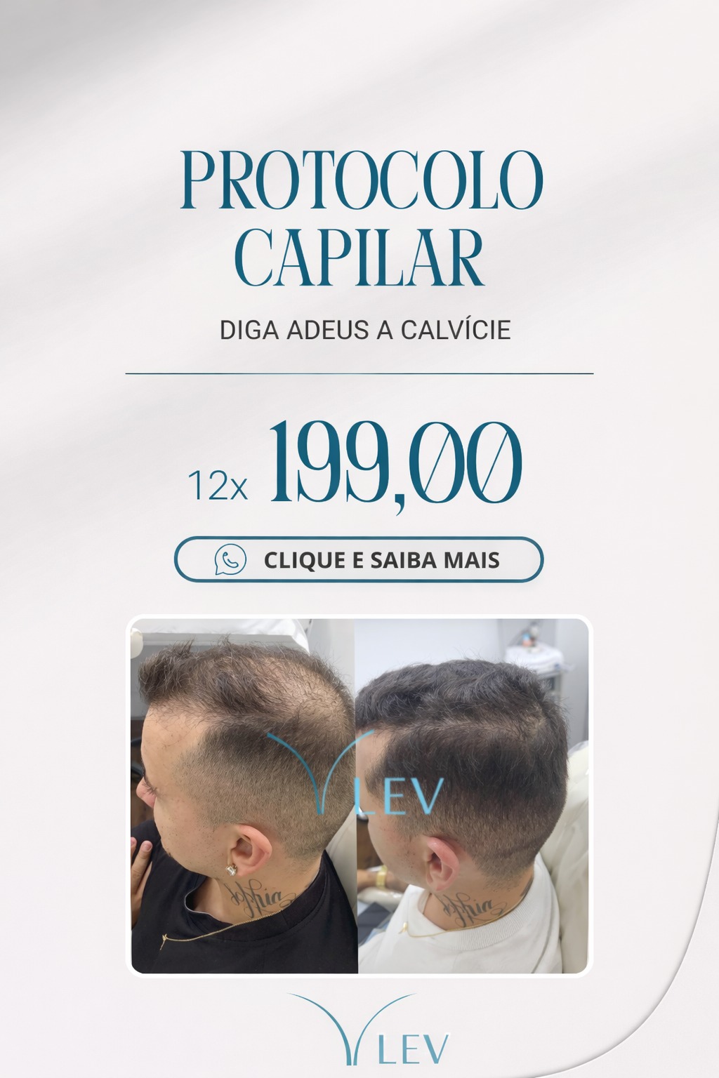 Clínica Lev - Protocolo Capilar